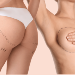 chirurgia plastica (1)